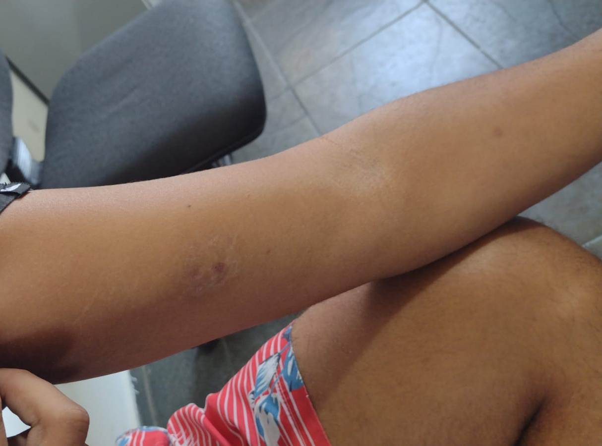 MULHER ESCAPA DE AGRESSÃO MORDENDO HOMEM