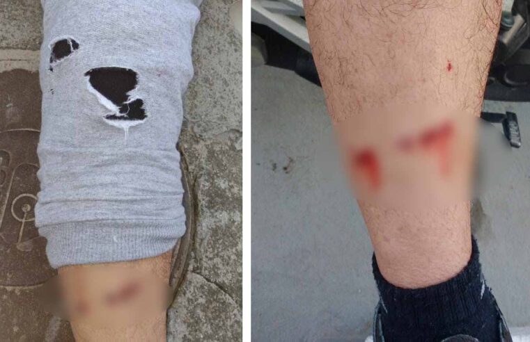 MORDIDO POR CÃO, HOMEM BUSCA JUSTIÇA E COBRA MAIS FISCALIZAÇÃO