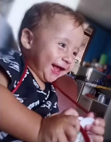 BEBÊ DE UM ANO É ATACADO POR CACHORRO DA RAÇA ROTTWEILER E LUTA PELA VIDA