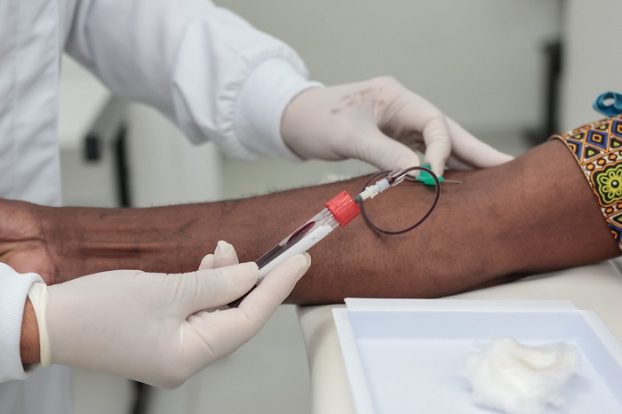 PARANÁ ANUNCIA COMPLEMENTO DE 16,6% PARA GARANTIR ATENDIMENTO DE PACIENTES RENAIS