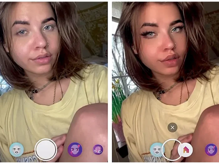 O IMPACTO DOS FILTROS DO INSTAGRAM NA BUSCA PELA CIRURGIA PLÁSTICA